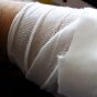 der linke Arm der linke Arm